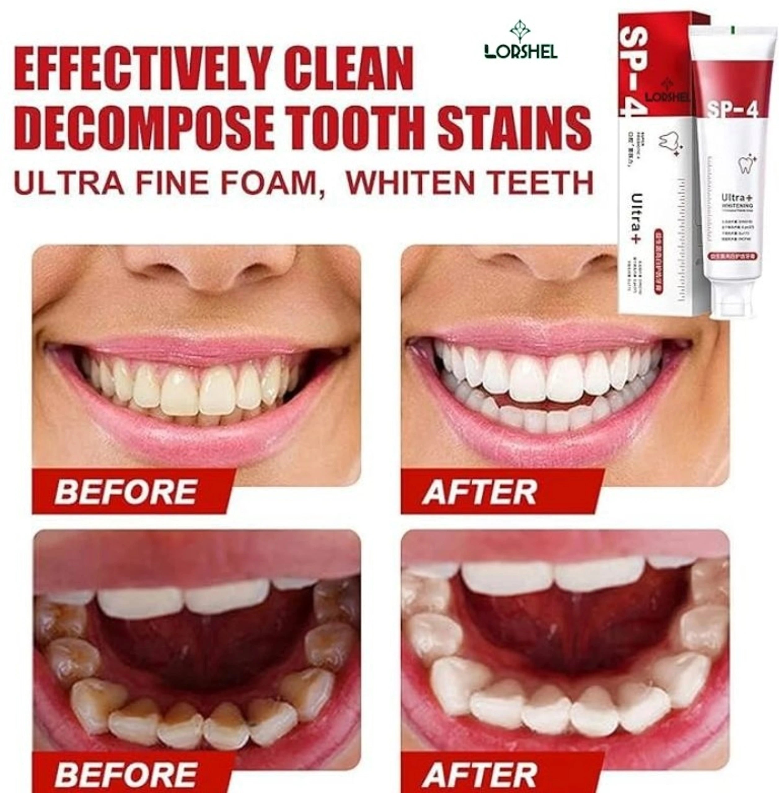 SP4 Probiotic Teeth  Whitening Toothpaste (Pack of 2)